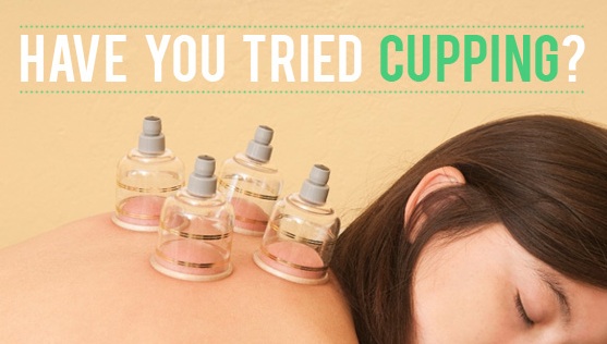 haveyoutriedcuppingpic