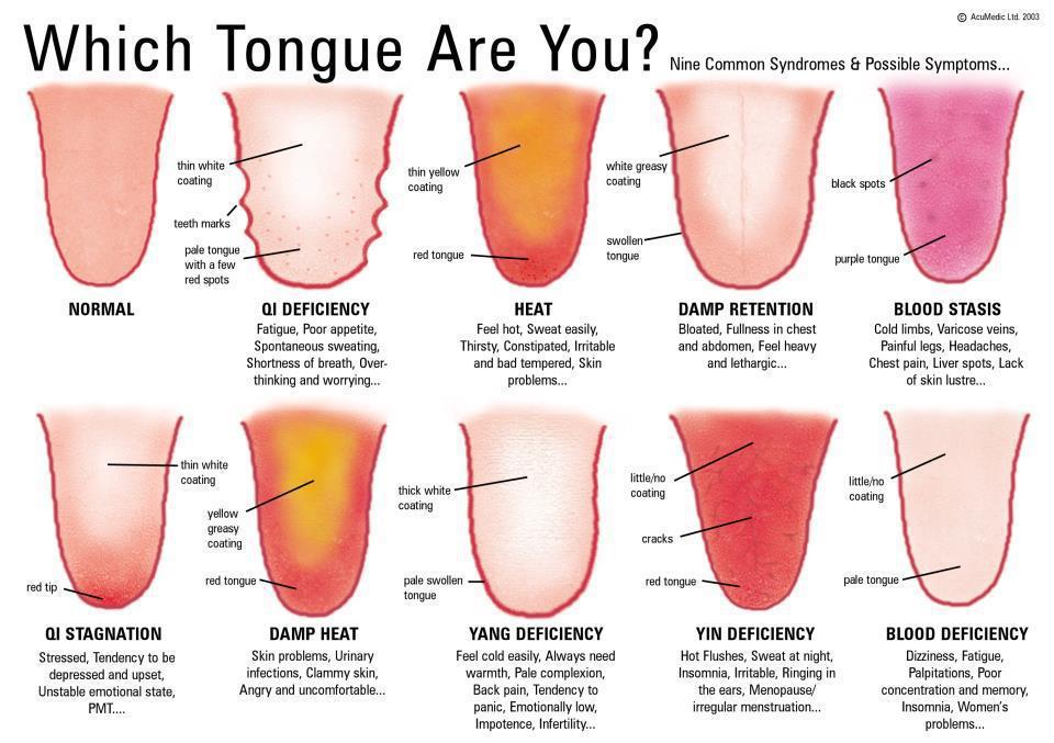 burning-tongue-9-causes-one-life-threatening-scary-symptoms